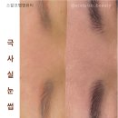 스칼프랩앤뷰티 속눈썹&눈썹&탈모 의정부점 이미지