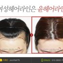 윤헤어라인의원