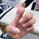 담아네일 | [수유] 물어뜯는 손톱, 교조증, 아크릴 네일 진행 과정 <뷰티아살롱> - 손톱교정 3회차