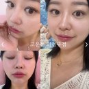 고운:눈 의정부점 | 의정부 속눈썹연장 잘하는 고운눈 의정부점, 연장 후기