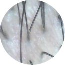 상남동142 | 꼼꼼한 맞춤 클리닉전문 창원상남동미용실 W살롱 두피클리닉 후기