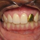 골드크라운 이미지