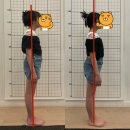 양주고읍 14단지 | 🎀 난소 나이(AMH) 검사, 서울시 국가지원으로 무료로 받는 법 + 실제 후기 [거주지 양주시 고읍]