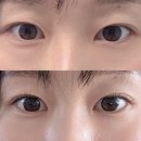 209-2-000007 | 안양속눈썹 바비걸 LED 포인트 속눈썹 연장 시술 솔직 후기
