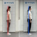 화인헬스케어 | 망원동 1인 pt 받고 체형교정, 허리/어깨/발 통증 개선 완료! *8회 만의 변화*