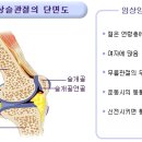 슬개골연골연화증(Chondromalacia Patella)이란? 이미지