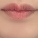 쥬네르의원 네이버블로그