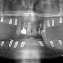 바른길치과 이미지