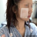 강남 에스테틱샵에서 추천하는 넘버퍼센트 듀얼패드 후기