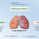 폐 고주파 절제술(Lung Radiofrequency Ablation, Lung RFA) 국소 비수술적 열치료 ​ 이미지