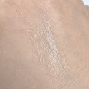 큰다나약국 | 여드름 흉터 없애는법 여드름 연고?