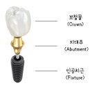 페이스치과기공소 네이버블로그