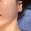 우동 신일교회 | 부산 해운대 피부관리 잘하는 한에스테틱 수분관리 후기