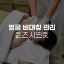 칭한의원 | 대구피부관리 퀸즈시크릿 비대칭관리 받고 왔어요