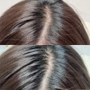 (주)코리아레드진생 | 다이소 샴푸 추천! 알지쓰리 레드진생 탈모라인 탈모샴푸 스케일러 사용후기