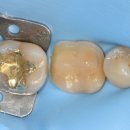 세라믹치과기공소 이미지