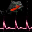 엔도소노 이미지