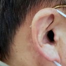 소리누리보청기 이미지