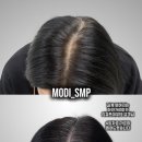 수원-1553 | 두피문신 부작용 걱정된다면? 병점·오산·동탄 고객 후기 기준으로 알려드림