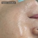 바른코스메디컬 이미지