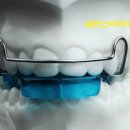 바이오치과 기공소 이미지