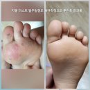 지엘(xiel) 네이버블로그