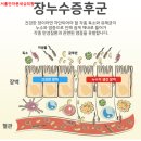 이지이비인후과의원 | 자율신경치료 후기｜장루수 증후군으로 인한 미열·인후통·전신통증이 사라진 이유