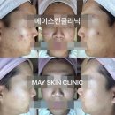 메이 스킨클리닉