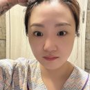팝성형외과의원 | 팝성형외과 눈 재수술 솔직후기｜세미아웃 라인 선택한 이유