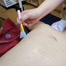강릉중앙초등학교 | 강릉 피부샵 ‘거꾸로가는시간’ 등 바디필링 솔직 후기