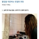 발바락 물집 치료 이미지