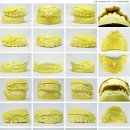 바른치과기공소 이미지