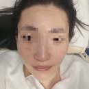 뽐뽐뷰티 | 울산 신정동피부 관리 뽐뽐뷰티 물방울리프팅 후기
