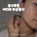 두피엔 에디쁘 | 두피괄사 후기 에디쁘 화산괄사 매일 사용 중
