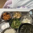 주내약국 | 경주 맘존여성병원 제왕절개 후기 2 (4일차~6일차)