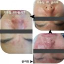 산소 덤
