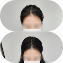 울산 속눈썹펌, 헤어라인 에르모사뷰티 다녀온 솔직 후기