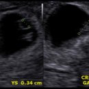 드림아이의원 이미지
