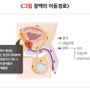 전립성비대증 자연치유법 이미지