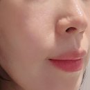 프로 | 메디큐브부스터프로 내돈내산 후기 효과있나