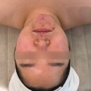 수화 | 얼굴 홍조 때문에 고민이라면? 청주 최예란에스테틱 수화강테라피 후기