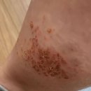 제오피부과의원 이미지