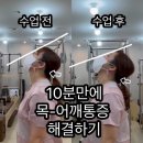 박지선헤어라인 | 정발산재활피티 10분 만에 목 어깨 통증 해결 방법