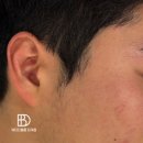 세븐일레븐 춘천퇴계점 | [춘천왁싱] 춘천남자구렛나루왁싱, 춘천퇴계동왁싱샵, 춘천왁싱잘하는곳 뷰티디블룸퇴계점:)