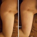 김해피부관리 힐링하우스 팔뚝살 다이어트 후기 김해에스테틱 추천