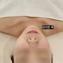 아벨라 에스테틱 | 대전 탄방동 에스테틱 아벨라뷰티 | 온업리프팅으로 작은 얼굴 만들기 윤곽 관리한 후기