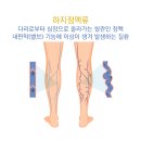 연합의원 | 하지정맥류 설명 + 고압산소치료 병행 + 우림연합의원 방문 후기