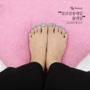 아이율네일