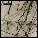 에츠하임 이미지