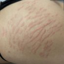 스킨52부천지부 이미지